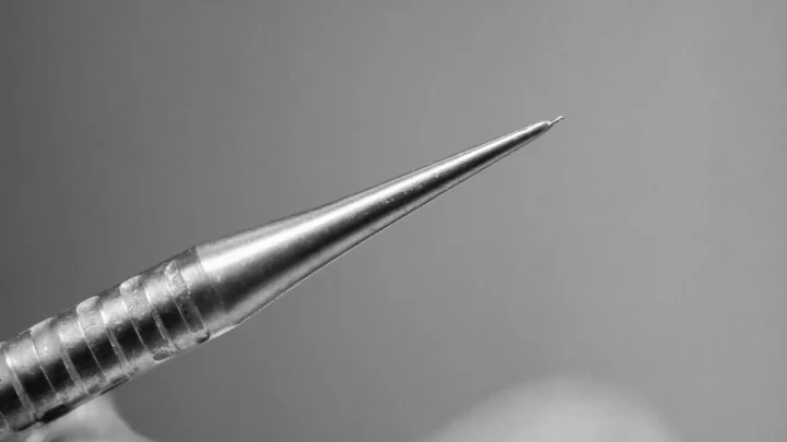 В медцентре Рошаля спасли 13-летнюю девочку, проглотившую стоматологический штифт