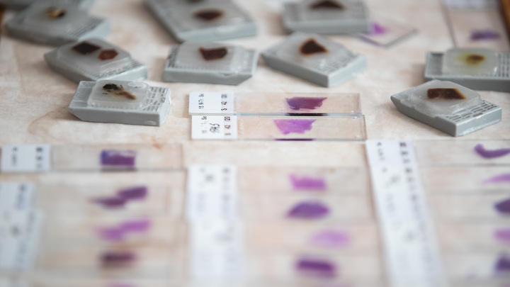 Смертельнее на 40%: Новый штамм B117 оказался в разы опаснее старого коронавируса - СМИ