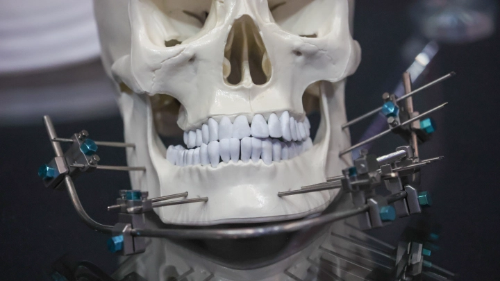 Пломба из маникюрного салона: почему русские рискуют остаться без зубов