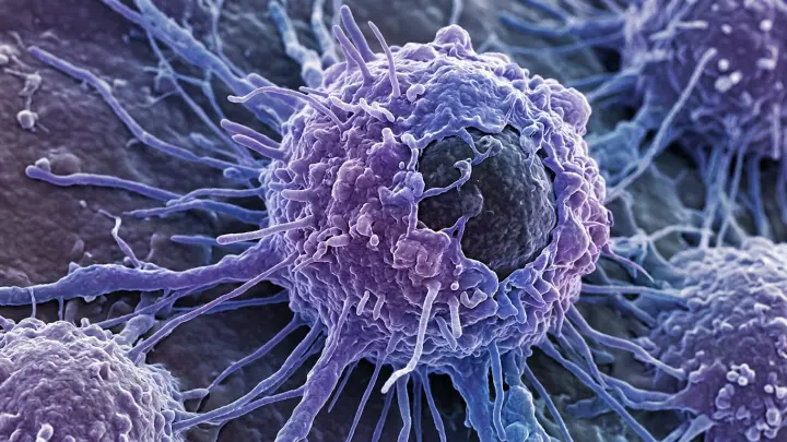 Учёные МГУ нашли способ заставить раковые клетки уничтожать себя