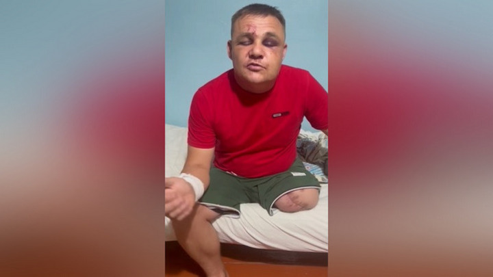 Глава СПЧ обратился в прокуратуру Забайкалья из-за нового поворота в деле избиения участника СВО