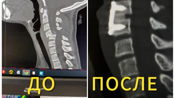 В Москве школьницу парализовало во время тренировки