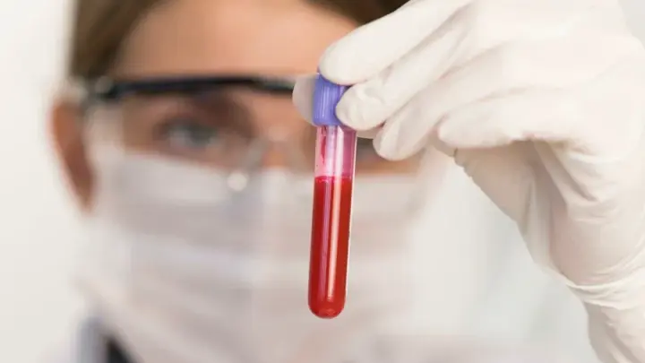 NJ: Ученые выяснили, как овсяное молоко влияет на уровень «плохого» холестерина