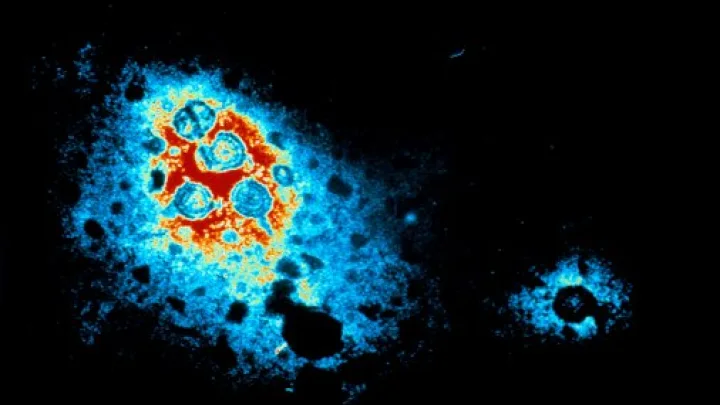 Daily Mail: предложено научное объяснение видениям при клинической смерти