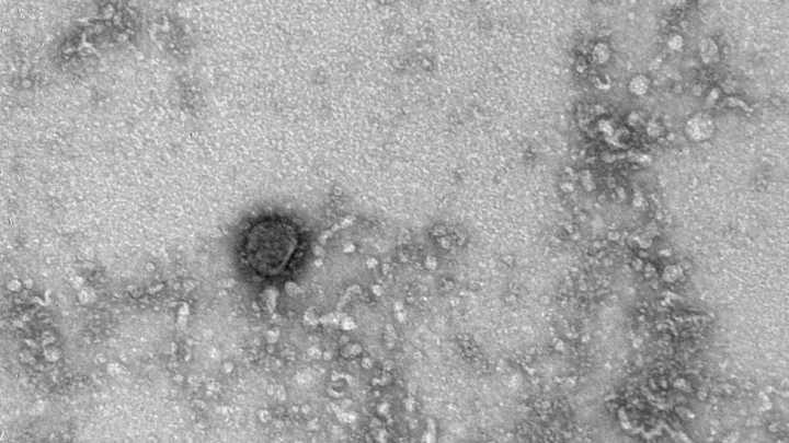 «Врут в обе стороны»: Экс-ведущий НТВ Глеб Пьяных раскритиковал тесты «Вектора» на коронавирус