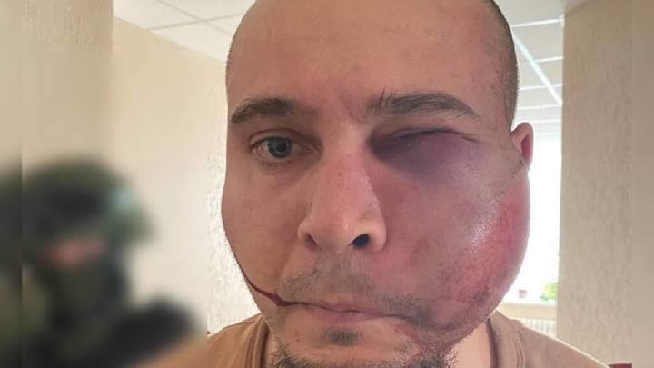 Праздник на костях: врач-нацист из Белоруссии отмечал день гибели жертв теракта в Крокусе