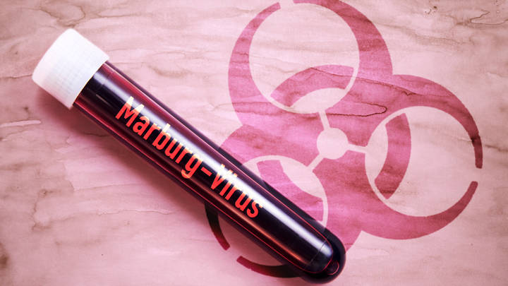 Кровь из глаз и диарея: В Европу завезли новую, схожую с Эболой болезнь. ВОЗ заявила об угрозе эпидемии