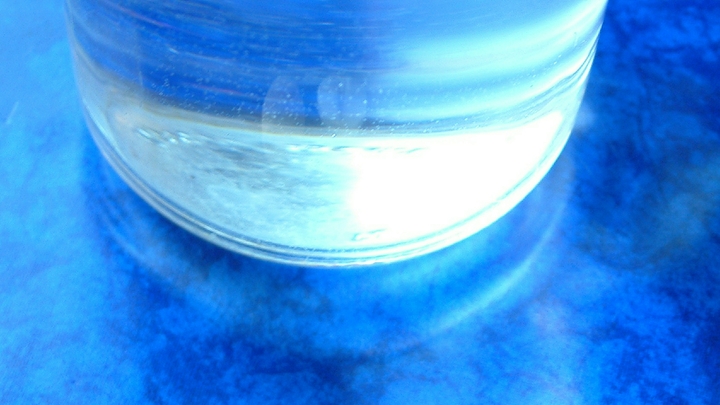 Назван неожиданный симптом опухоли мозга: что указывает на опасную болезнь