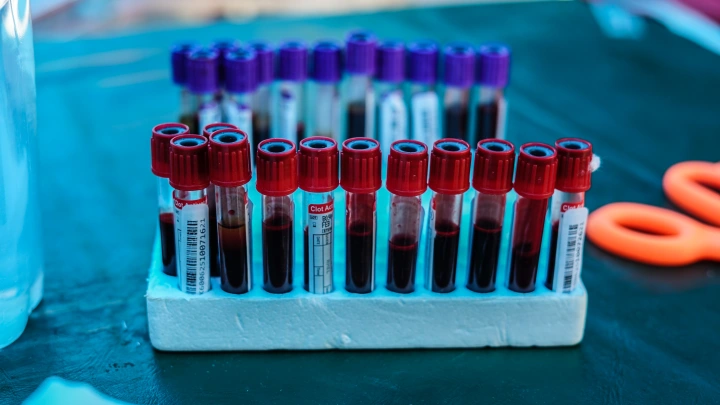 В Индии открыли новую группу крови. Правда, пока её нашли только у одного человека