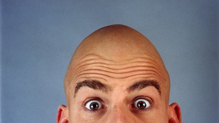 О чём говорят морщины на лбу? Учёные указали на решающий признак