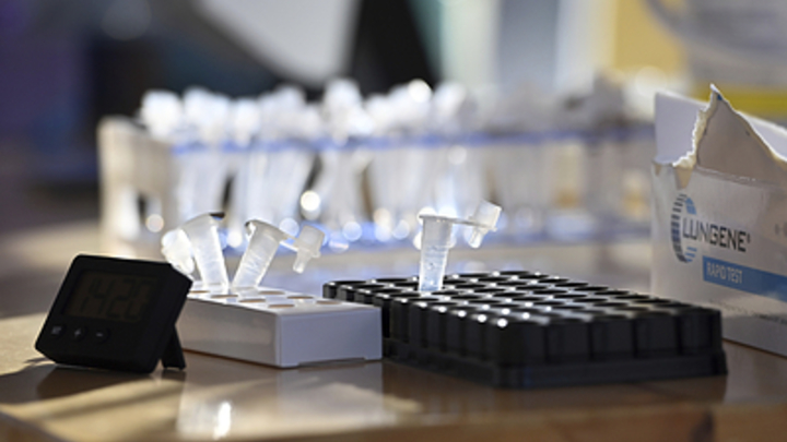 Настигают после COVID-19: Врач рассказала о двух опасных болезнях