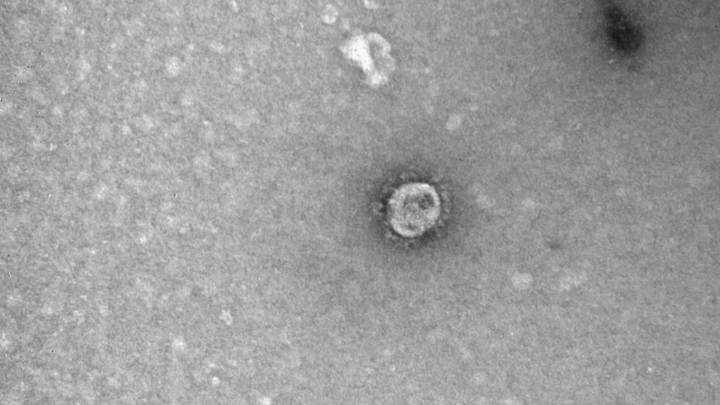 Приём заявок от новосибирцев на бесплатное тестирование на антитела к COVID-19 почти закончен
