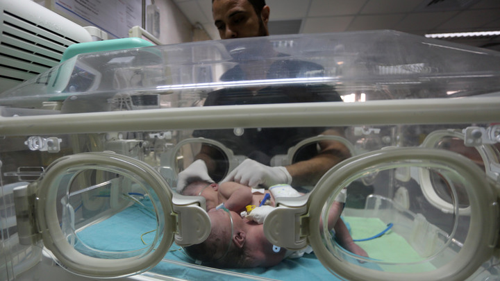Впервые такое вижу: Младенца с двумя головами доставили в реанимацию