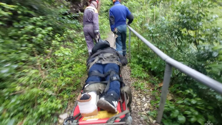 Путешествие туристки из Москвы в Сочи закончилось переломом ноги