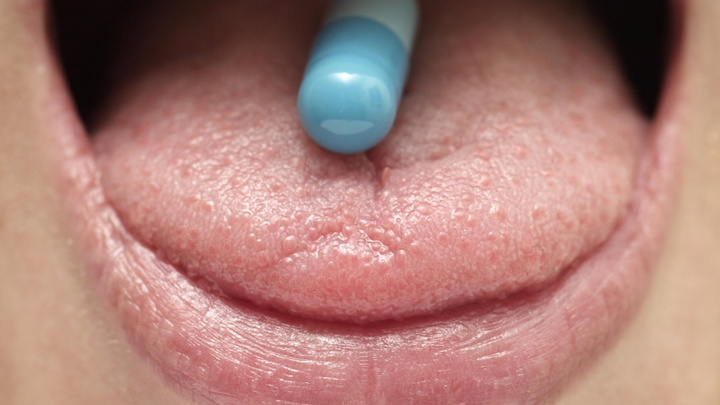 Что означает белый налёт на языке и как его убрать