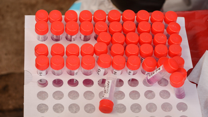 Переболевших в 2003-м ковид не берет: Западные учёные опубликовали сенсационные данные