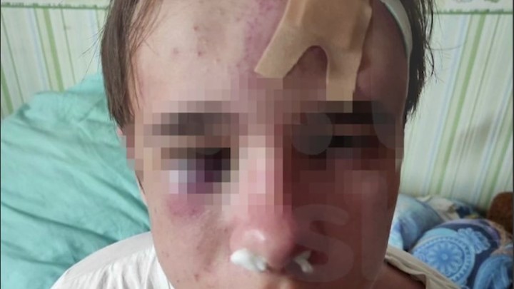 В Петербурге мужчины, избившие 16-летнего подростка за серьгу в ухе, отправлены в СИЗО