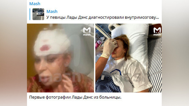 Mash: Опубликованы первые фотографии певицы Лады Дэнс после ДТП