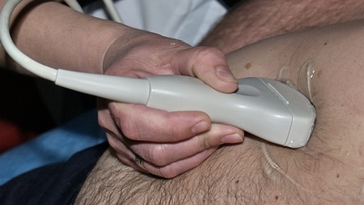 Онколог предупредил мужчин с лишним весом: Увеличивает риск рака