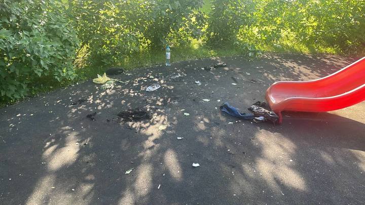 В Москве подросток играл с бензином и получил ожоги 80% тела