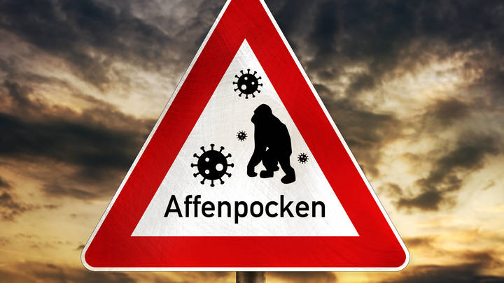 Шансы падения кирпича на голову значительно выше: Врач научил, как реагировать на оспу обезьян