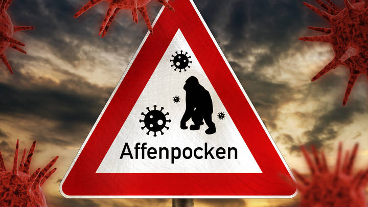 Оспа обезьян унесла ещё одну жизнь: Первый случай в Перу