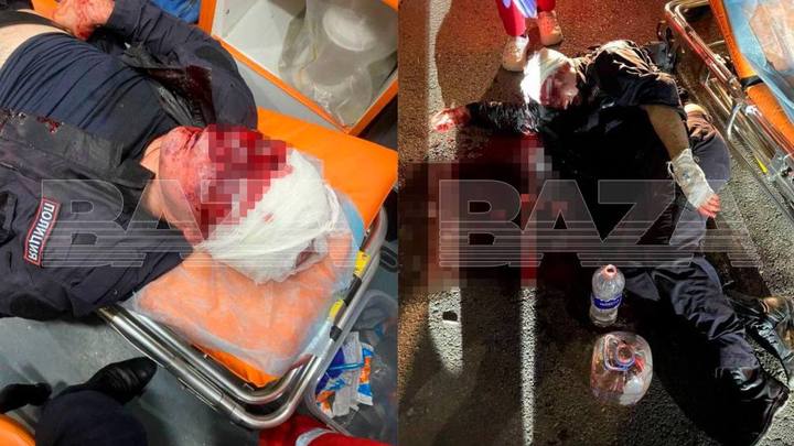 В Краснодаре сотрудник ДПС попал в больницу с переломом носа и сотрясением мозга