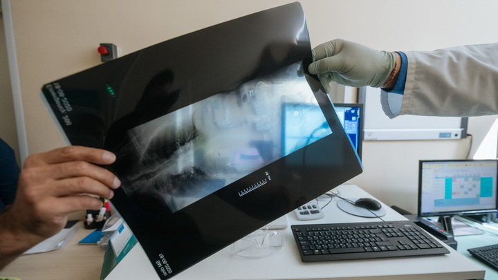 Лёгкие умирают: Учёные рассказали о последствиях заражения COVID-19 у курильщиков