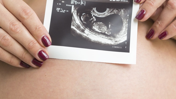 Споры по абортам. В думском комитете раскол?