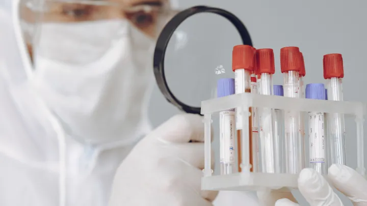 10 мигрантов с ВИЧ нашли в Туле