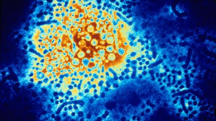 Ученые из США выяснили, что происходит в разуме человека после смерти