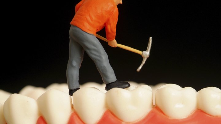 Нельзя ждать: Врач назвал случай, когда к стоматологу стоит бежать даже в праздники