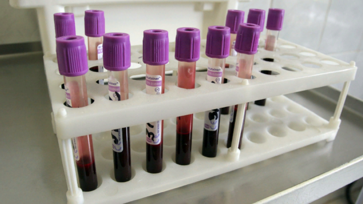 Россия и США ищут лекарство от ВИЧ. Но метод может привести и к спасению от рака