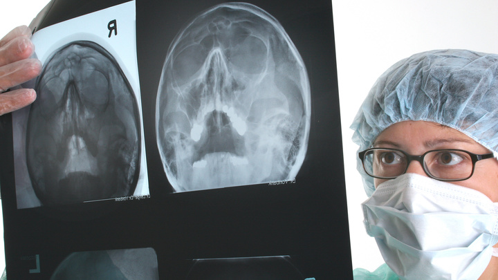 Врачи назвали три симптома рака, которые игнорируют чаще всего