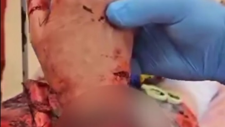 В Сочи собаки покусали женщину, которая их кормила