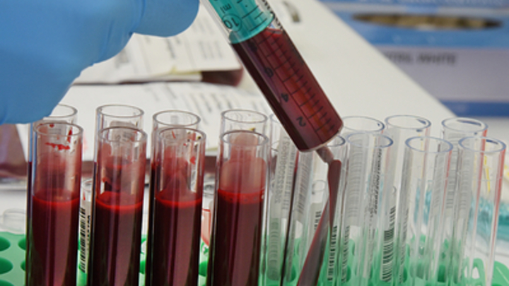 Русские дипломаты раскрыли глаза американцам на проделки Пентагона с вирусами на Украине