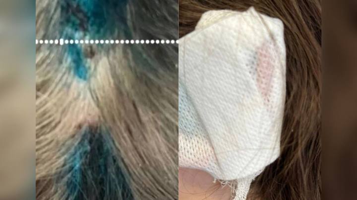 В Новороссийске полиция разыскивает хозяина бойцовского пса, который покусал 12-летнюю девочку